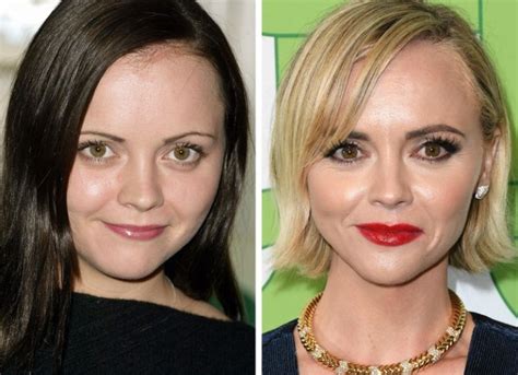 Christina Ricci Opens up about Her Plastic Surgery at Age 19